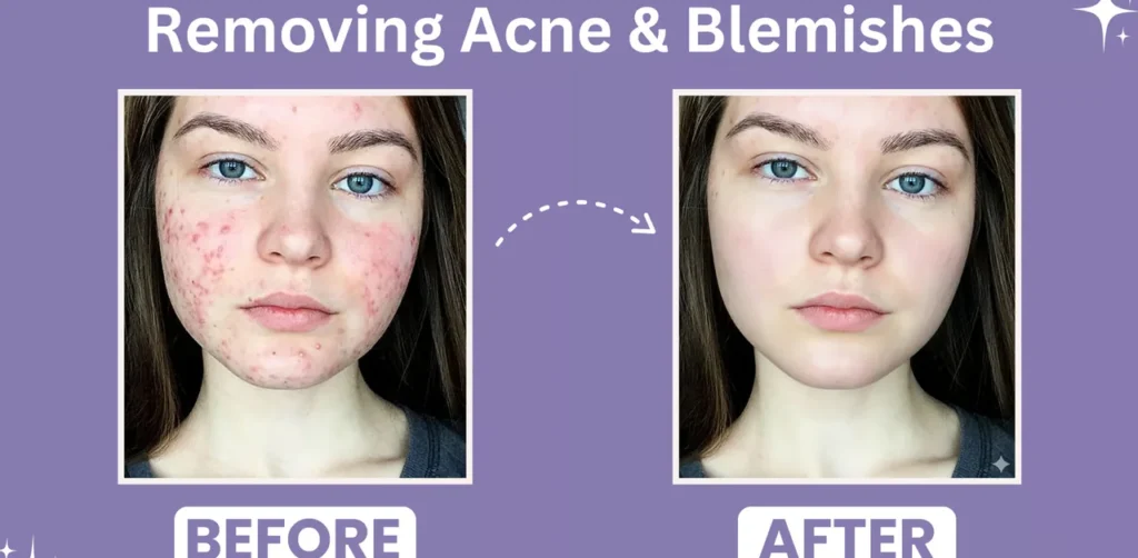 Retouching and Skin Fixes